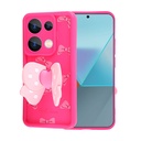 Xiaomi Poco M6 Pro 4G Kılıf Kamera Korumalı Figür Tasarımlı Zore Kapya Kapak - 1