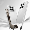 Xiaomi 14T Pro Kılıf Airbagli Takılabilir Askı Aparatlı Zore Snap Silikon Kapak - 1