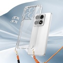 Xiaomi 14T Pro Kılıf Airbagli Takılabilir Askı Aparatlı Zore Snap Silikon Kapak - 5