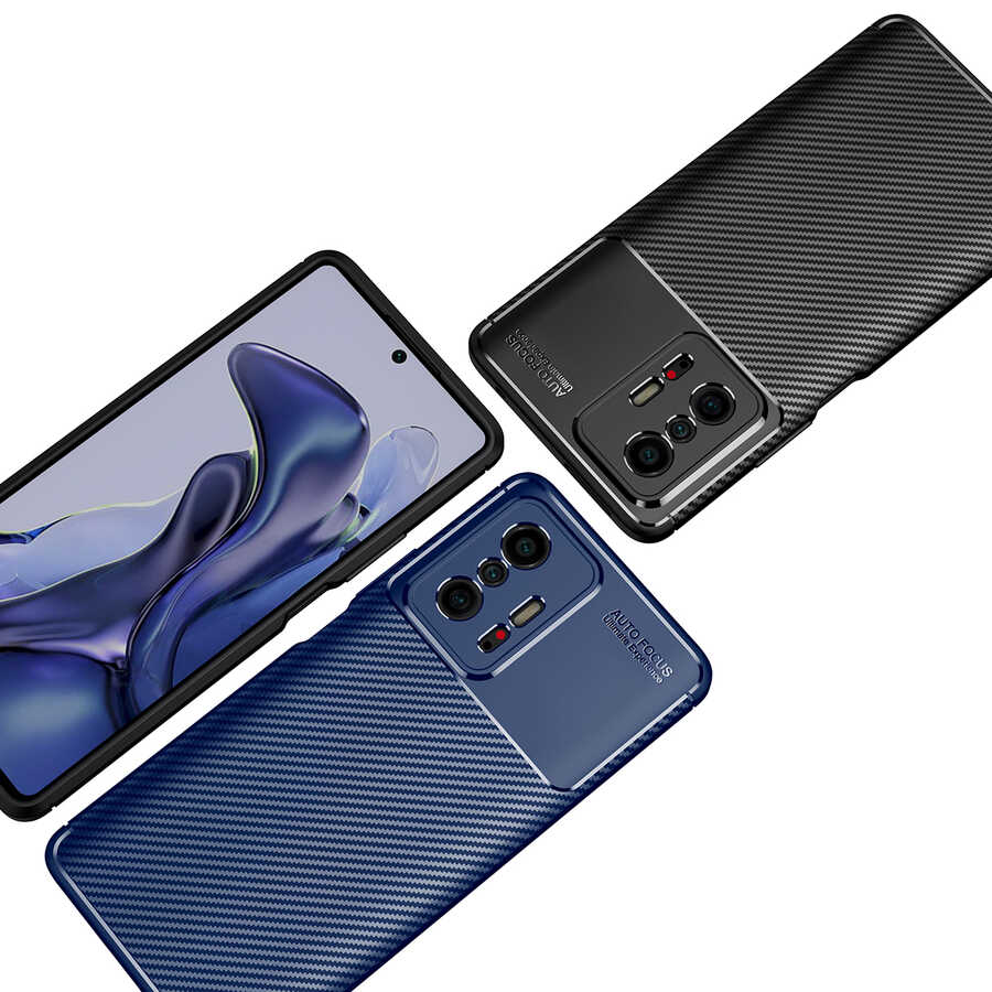 Xiaomi Mi 11T 5G Uyumlu Kılıf Zore Negro Silikon Kapak - 7