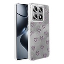 Xiaomi 14T Uyumlu Kılıf Kamera Korumalı Figürlü Zore Ponti Silikon Kapak