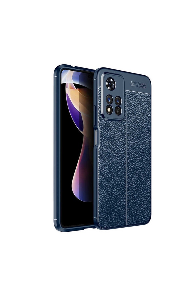 Xiaomi Redmi Note 11 Pro 5G Uyumlu Kılıf Zore Niss Silikon Kapak
