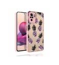 Xiaomi Redmi Note 10S Uyumlu Kılıf Desenli Kamera Korumalı Parlak Zore Nora Kapak