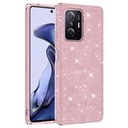 Xiaomi Mi 11T 5G Uyumlu Kılıf Zore Shining Silikon